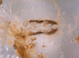 Mouth parts of a beetle larvae. 